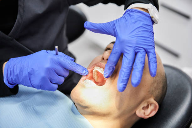 Best Knocked-Out Tooth (Avulsed Tooth) Treatment in Arp, TX
